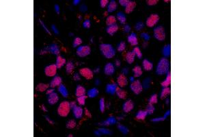 Immunofluorescence (IF) image for anti-RAD23 Homolog B (RAD23B) (AA 359-409) antibody (ABIN7449006) (RAD23B 抗体  (AA 359-409))