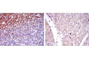 Immunohistochemical analysis of paraffin-embedded human cerebellum tissues (left) and human liver cancer tissues (right) using CD15 mouse mAb with DAB staining. (CD15 抗体)