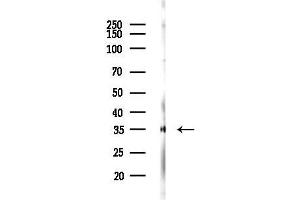 anti-Mitochondrial Ribosomal Protein L15 (MRPL15) (Internal Region) antibody