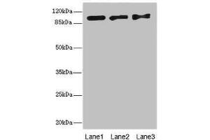 Western blot All lanes: EXO1 antibody at 10 μg/mL Lane 1: Hela whole cell lysate Lane 2: 293T whole cell lysate Lane 3: A549 whole cell lysate Secondary Goat polyclonal to rabbit IgG at 1/10000 dilution Predicted band size: 95, 90 kDa Observed band size: 95 kDa (Exonuclease 1 抗体  (AA 301-600))