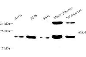 Western blot analysis of Akip1 (ABIN7072871) at dilution of 1: 800 (AKIP1 抗体)