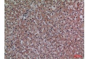 Immunohistochemistry (IHC) analysis of paraffin-embedded Human Liver, antibody was diluted at 1:100. (CRP 抗体  (Internal Region))