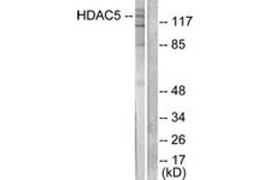 Western blot analysis of extracts from HepG2 cells, treated with PMA 125ng/ml 30', using HDAC5 Antibody. (HDAC5 抗体  (AA 1073-1122))