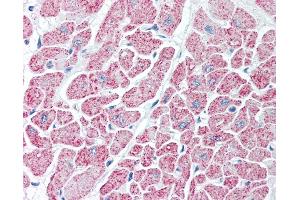 Anti-IDH antibody IHC of human heart. (Isocitrate Dehydrogenase 抗体)