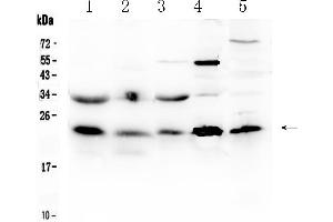 Western blot analysis of HSPB8/Hsp22 using anti- HSPB8/Hsp22 antibody . (HSPB8 抗体  (AA 1-196))