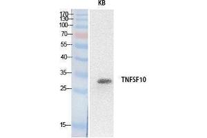 Western Blotting (WB) image for anti-Tumor Necrosis Factor (Ligand) Superfamily, Member 10 (TNFSF10) (Internal Region) antibody (ABIN3178527) (TRAIL 抗体  (Internal Region))