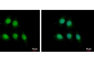 ICC/IF Image MAGE 1 antibody [N1C3] detects MAGE 1 protein at nucleus and cytoplasm by immunofluorescent analysis.
