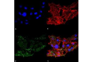 Immunocytochemistry/Immunofluorescence analysis using Rabbit Anti-ATG7 Polyclonal Antibody . (ATG7 抗体  (N-Term) (FITC))