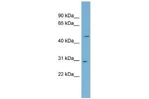 NDUFS3 antibody used at 1 ug/ml to detect target protein. (NDUFS3 抗体  (Middle Region))