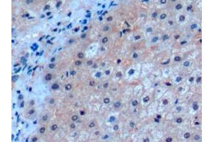 Detection of ICOSLG in Human Liver Tissue using Polyclonal Antibody to Inducible T-Cell Co Stimulator Ligand (ICOSLG) (ICOSLG 抗体  (AA 23-249))