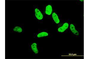 Immunofluorescence of monoclonal antibody to ZNF207 on HeLa cell. (ZNF207 抗体  (AA 1-110))
