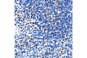 Immunohistochemistry of paraffin-embedded rat spleen using CRM1/XPO1 antibody (ABIN7267067) at dilution of 1:100 (40x lens). (XPO1 抗体)