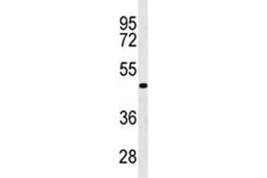 Western blot analysis of GATA6 antibody in WiDr lysate. (GATA6 抗体  (AA 254-279))