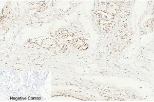 Immunohistochemical analysis of paraffin-embedded human breast tissue. (Caspase 8 抗体  (Cleaved-Asp384))