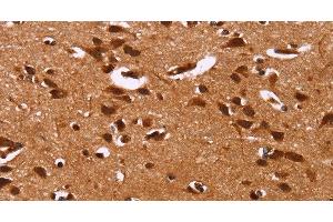 Immunohistochemistry of paraffin-embedded Human brain tissue using HRK Polyclonal Antibody at dilution 1:40 (HRK 抗体)