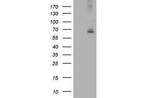 Western Blotting (WB) image for anti-IlvB (Bacterial Acetolactate Synthase)-Like (ILVBL) antibody (ABIN1498881) (ILVBL 抗体)