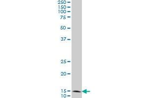 FIS1 monoclonal antibody (M01), clone 1G9 Western Blot analysis of FIS1 expression in A-431 .