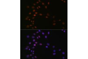 Immunofluorescence analysis of NIH-3T3 cells using L Rabbit mAb (ABIN7270266) at dilution of 1:100 (40x lens). (ASH2L 抗体)