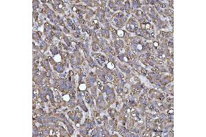 IHC analysis of MRPS22 using anti-MRPS22 antibody (ABIN7600613). (MRPS22 抗体  (AA 21-329))