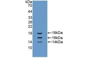 Detection of Recombinant IL15, Bovine using Polyclonal Antibody to Interleukin 15 (IL15)