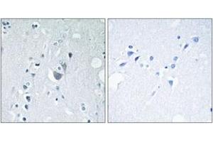 Immunohistochemistry analysis of paraffin-embedded human brain, using SAPK/JNK (Phospho-Tyr185) Antibody. (SAPK, JNK (AA 151-200), (pTyr185) 抗体)