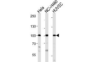 Western blot analysis of lysates from Hela, NCI-H460, HUVEC cell line (from left to right), using EPHA4 Antibody (R890) at 1:1000 at each lane. (EPH Receptor A4 抗体  (C-Term))