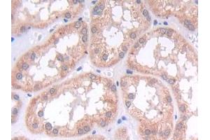 DAB staining on IHC-P; Samples: Human Kidney Tissue (LAMB2 抗体  (AA 38-350))