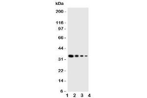 Western blot testing of GCN2 antbody (GCN2 抗体  (Middle Region))