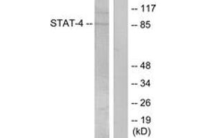 Western blot analysis of extracts from HeLa cells treated with IL-4, using STAT4 (Phospho-Tyr693) Antibody. (STAT4 抗体  (pTyr693))