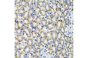 Immunohistochemistry of paraffin-embedded rat kidney using COMT antibody (ABIN1882327) at dilution of 1:100 (40x lens). (COMT 抗体)