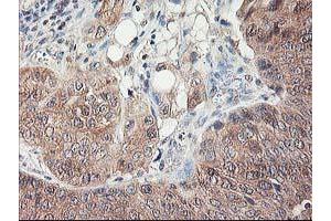 Image no. 3 for anti-NIF3 NGG1 Interacting Factor 3-Like 1 (NIF3L1) antibody (ABIN1496618)