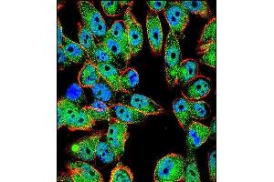 Confocal immunofluorescent analysis of p53 Antibody (T55) (ABIN390200 and ABIN2840687) with  cell followed by Alexa Fluor 488-conjugated goat anti-rabbit lgG (green). (p53 抗体  (AA 33-62))