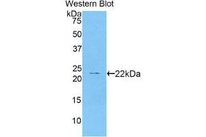 Western Blotting (WB) image for anti-Cathelicidin Antimicrobial Peptide (CAMP) (AA 31-170) antibody (ABIN1858227) (Cathelicidin 抗体  (AA 31-170))
