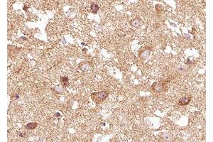 Immunohistochemistry (IHC) image for anti-Neurotrophic Tyrosine Kinase, Receptor, Type 2 (NTRK2) (pTyr516) antibody (ABIN6255941)
