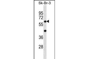 STXBP3 Antibody (Center) (ABIN656402 and ABIN2845696) western blot analysis in SK-BR-3 cell line lysates (35 μg/lane). (STXBP3 抗体  (AA 145-171))