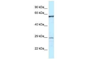 Western Blot showing PTPN6 antibody used at a concentration of 1 ug/ml against THP-1 Cell Lysate (SHP1 抗体  (Middle Region))