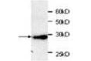 Image no. 1 for anti-Red Fluorescent Protein (RFP) (AA 21-245) antibody (ABIN791466) (RFP 抗体  (AA 21-245))
