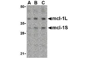 Western Blotting (WB) image for anti-Induced Myeloid Leukemia Cell Differentiation Protein Mcl-1 (MCL1) (Center) antibody (ABIN2475516)