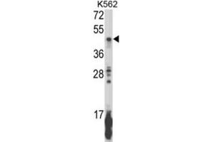 Western Blotting (WB) image for anti-Killer Cell Immunoglobulin-Like Receptor, Two Domains, Long Cytoplasmic Tail, 5B (KIR2DL5B) antibody (ABIN3003959) (KIR2DL5B 抗体)