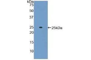 Detection of Recombinant ADCY6, Mouse using Polyclonal Antibody to Adenylate Cyclase 6 (ADCY6) (ADCY6 抗体  (AA 314-501))