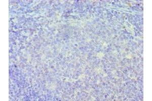 Immunohistochemistry of paraffin-embedded human tonsil tissue using ABIN7156635 at dilution of 1:100 (IRF8 抗体  (AA 137-426))