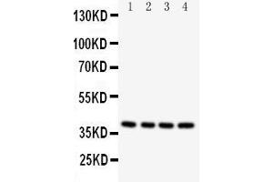 Western Blotting (WB) image for anti-Caspase 12 (Gene/pseudogene) (CASP12) (AA 71-84), (N-Term) antibody (ABIN3042658) (Caspase 12 抗体  (N-Term))