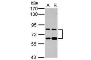 Image no. 1 for anti-Zinc Finger Protein 64 (ZFP64) (AA 394-681) antibody (ABIN1501818) (ZFP64 抗体  (AA 394-681))