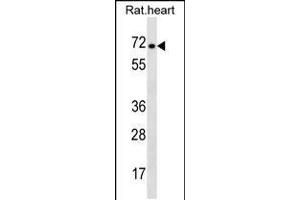 Western blot analysis in rat heart tissue lysates (35ug/lane). (STRA6 抗体  (C-Term))