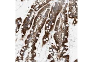 Immunohistochemical staining of human small intestine with MCOLN3 polyclonal antibody  shows strong cytoplasmic positivity at 1:20-1:50 dilution. (Mucolipin 3 抗体)