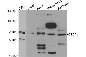 Western blot analysis of extracts of various cell lines, using CTCFL antibody. (CTCFL 抗体)