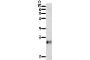 Gel: 12 % SDS-PAGE, Lysate: 50 μg, Lane: Human fetal brain tissue, Primary antibody: ABIN7129442(FAM3A Antibody) at dilution 1/200, Secondary antibody: Goat anti rabbit IgG at 1/8000 dilution, Exposure time: 5 minutes (FAM3A 抗体)
