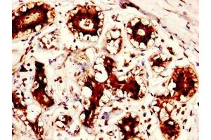 Immunohistochemistry (IHC) image for anti-Peptidyl Arginine Deiminase, Type II (PADI2) (AA 1-665) antibody (ABIN7166389)