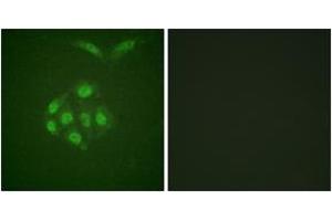 Immunofluorescence analysis of A549 cells, using Survivin (Phospho-Thr117) Antibody. (Survivin 抗体  (pThr117))