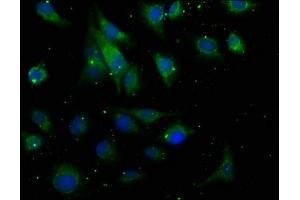 Immunofluorescence staining of U251 cells with ABIN7167172 at 1:50, counter-stained with DAPI.